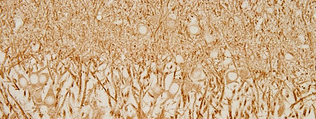 MAP-2 staining of apical dendrites (arrows) of