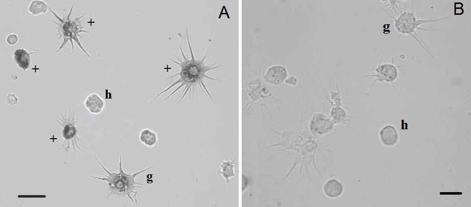 Fig. 4 (A) Light microscopy of hemocytes from L. stagnalis with peroxidase activity. (B) Effect of sodium azide on peroxidase activity in hemocytes from L. stagnalis. Abbreviations: g, granulocyte; h, hyalinocyte; + show peroxidase positive staining hemocytes.