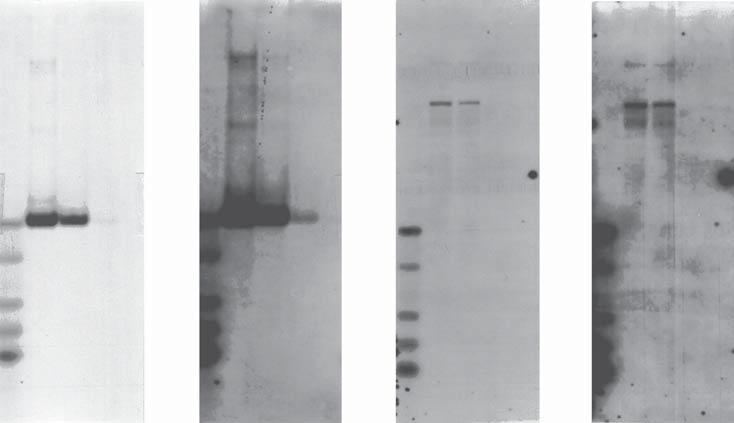 Techniques for Detection of Hybridization Probes on a Blot Chemiluminescent Methods for Detection of Probes on a Blot 4.1.4 Typical Results with the Chemiluminescent Detection Assay 1 2 4 Figure 15.