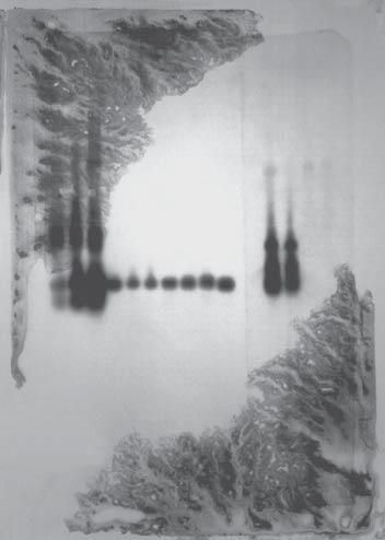 The grainy appearance of the background indicates that the drying occurred during the chemiluminescent procedure rather than during hybridization.