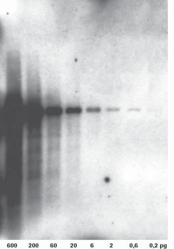 A model Northern blot system was designed to show the relative sensitivity of DIG-labeled DNA (B), DIG-labeled RNA (A), radioactively labeled RNA (C), and radioactively labeled DNA (D) as probes for
