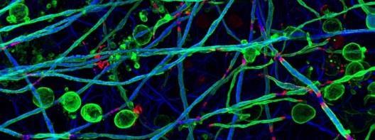 Cambridge & Edinburgh Exploring how remyelination can be encouraged Developing potential treatments and testing