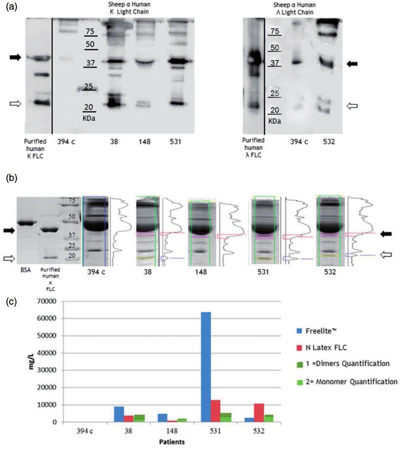 334 Annals of Clinical Biochemistry 52(3) Figure 6. Monomers and dimers analysis. (a) Western blot analysis of 0.2 mg of purified human k FLC or FLC and 15 mg of serum proteins (patient n.