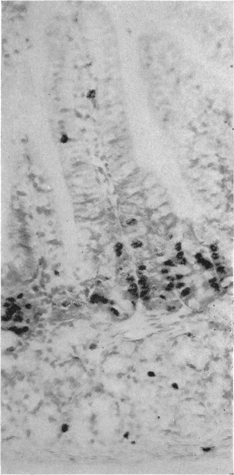 Duodenum showing labelled nuclei in cr.