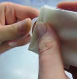(acetone) moistened tissue over the surface as long as the