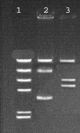 Detection The DNA molecules of different lengths will run as "bands DNA is stained (that is, colored)