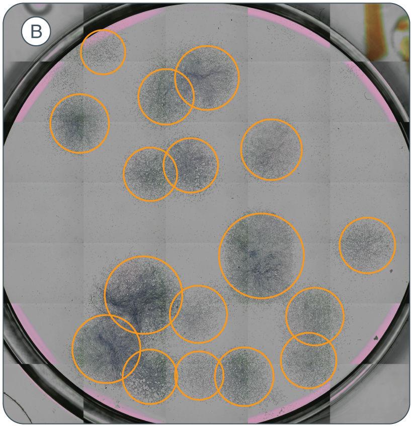 It is important to look at the CFU-F cultures under a microscope for confirmation because some colonies may not take up enough