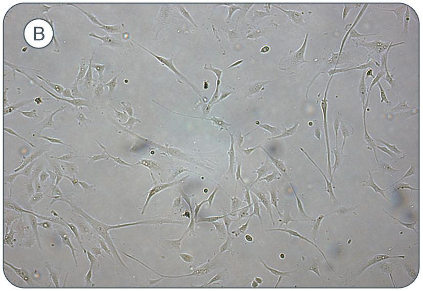 14 7.2 Cell Densities of MSCs Cultured in MesenCult -XF Medium It is important that cells are passaged when they reach 80% confluence.