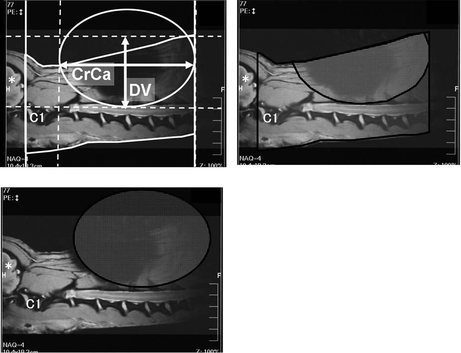MRI IN DOGS WITH MICROCHIPS 577 A B C Fig. 1. Artifact magnitude measurement on MR images.