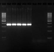INTERPRETATION OF RESULTS The analysis of amplification products is performed by horizontal electrophoresis in low EEO-agarose gels (e.g. MB Agarose, Ref. 20.011). Band visualisation is improved in 1.