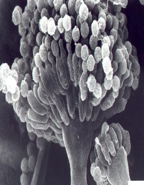 manganese oxidizing bacteria.