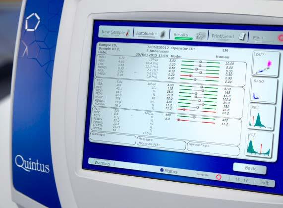 Plenty of room to display all 26-parameter results plus scattergrams and histograms, warnings, messages and flaggings. Barcode scanning of QC material assay sheets is easy to use and 100% secure.