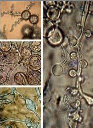 Morphological characteristics A. Chlamydospore germination, A B. sporangia C. hyphal swellings of P.