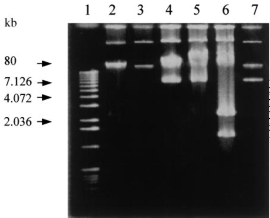 Galdbart et al Extended-spectrum b-lactamase-producing Enterobacter aerogenes âá" Figure 3 Plasmid pattern of TEM-24-producing Enterobacter aerogenes and transconjugant.