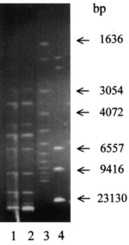 Figure 4 PstI ngerprint of plasmids encoding TEM-24 b-lactamase isolated from the Escherichia coli transconjugants. Lane 1: plasmid from Enterobacter aerogenes 2.