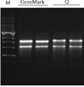 Non-denaturing gel electrophoresis analysis of total RNA purified from various samples using GeneMark Total RNA Purification Kit and related kit from supplier Q.