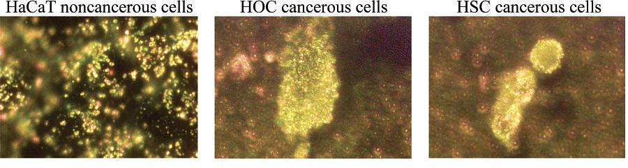 Figure 16. Light scattering images of HaCaT non-cancerous cells (left), HOC cancerous cells (middle), and HSC cancerous cells (column) after incubation with anti-egfr antibody conjugated gold NPs.