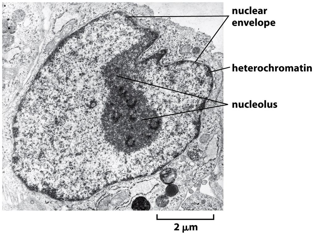 The nucleolus is the most prominent structure in the