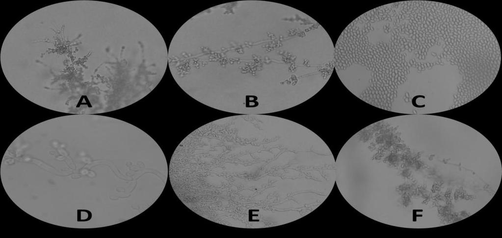 Fig.3 Morphology on Cornmeal agar: A - albicans, B