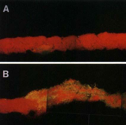 Biofilm Physiology 23 Species distribution Microbial Ecol. 33: 2-10, 1997.