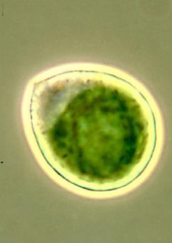 Why microalgae?