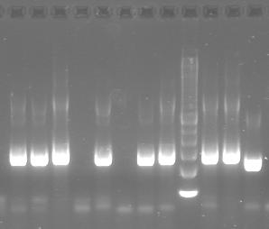Figure 2: Ethidium bromide stained gel showing PCR products (lanes 2-11) and DNA markers (lanes 1 and 12).