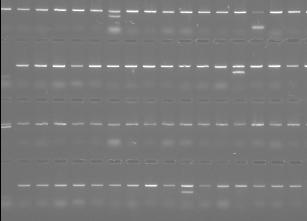 However, GeneTools will ensure each band is recognised separately and will be automatically analysed as a single band. Figure 5: Silver stained acrylamide gel showing SSCP DNA bands (lanes 1-24).