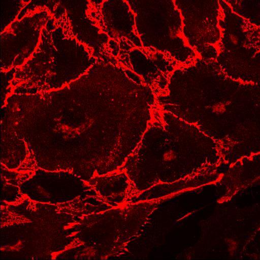 Endothelial cells such as HUVECs can be plated either sparse or confluent p22phox in focal adhesions