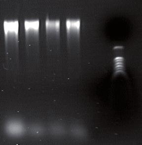 3: Agarose gel electrophoresis of purified DNA samples from Cabbage leaves (A1-A6), Pine Needles (A7-A12), Rose leaves (B1-B6) and Corn (B7-B12).