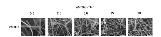 Clot quality and [thrombin] Thick Fiber thickness Thin Loose Fiber weave Tight High Vulnerability to fibrinolysis Low Wolberg, AS. Thrombin generation and fibrin clot structure.