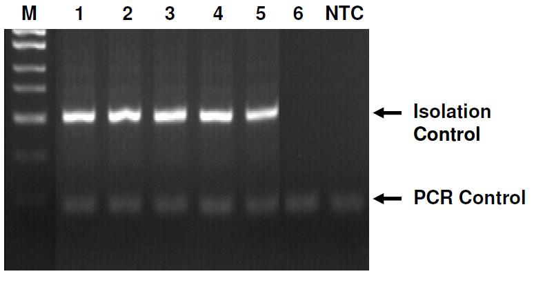 Figure 2: A representative 1X TAE 1.7% agarose gel showing the amplification of Isolation Control and PCR Control under different conditions using the Control 2X PCR Master Mix.