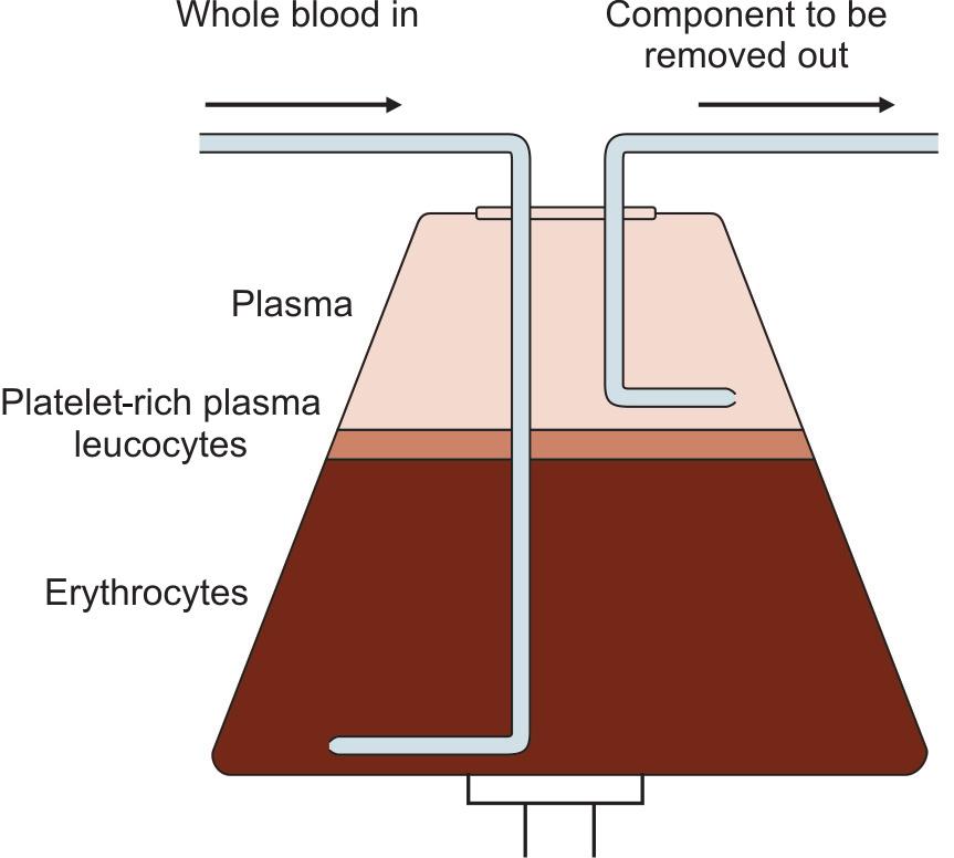 92 Essentials of blood banking Figure 15.3: Diagrammatic presentation of functioning of apheresis Both types of separators have their advantages and disadvantages.