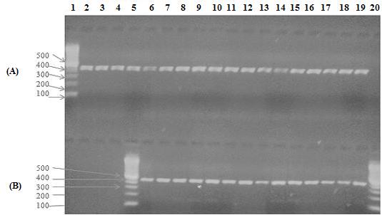3.2 Optimization of PCR-SSP Although the PCR-SSP technique was performed in this study as monoplex PCR, it was initially started as a multiplex by using two sets of primers including the internal