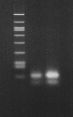 3. Gel Electrophoresis By PCR, amplified products can be seen. Check the amplified PCR products by 3% agarose electrophoresis according to the standard procedure.