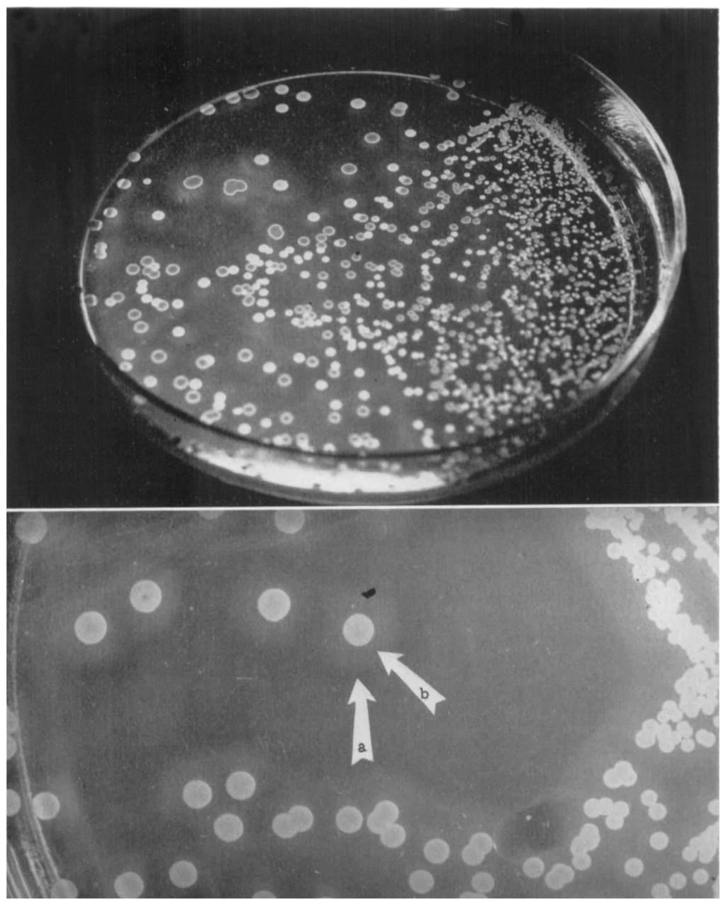 aureus surrounded by white coagulase-negative organisms. Precipitate appears around the pigmented colonies. White colonics close to <S.