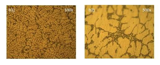 Microstructure Microstructural examination of the modified LM25 alloy was carried out to confirm the dispersion of Zr particles.