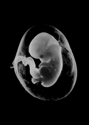 3 Look at the photograph of a human foetus. 8 Dr M.A. Ansary / Science Photo Library (a) The foetus is attached to the mother by the placenta. Look at the statements.