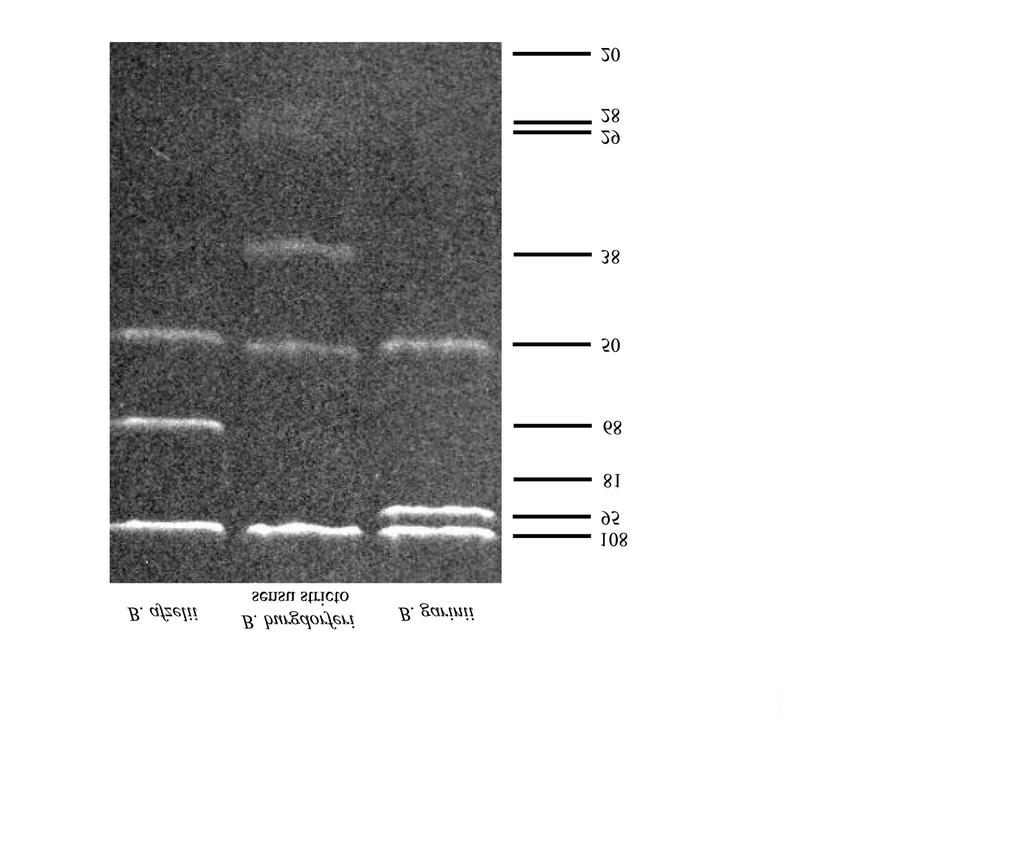 3.2 METODE Slika 14: Slika elektroforezne ločbe treh, za človeka najpogosteje patogenih, borelijskih vrst (IMI 2011; fotografija je bila dokumentirana s programom Quantity One, proizvajalca BioRad,