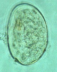 Reproduced from the University of Cambridge, http://www.path.cam.ac.uk/~schisto/helminth_eggs/index.html. S. mansoni - Eggs have lateral spines. S. japonicum - Eggs have very reduced terminal spines.