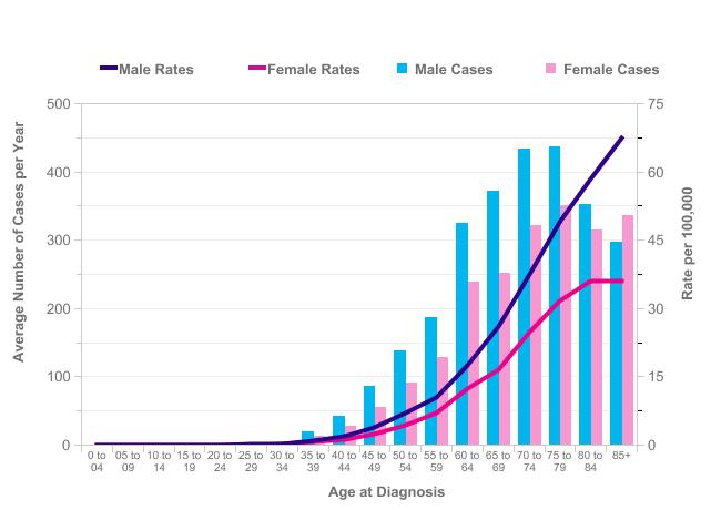 Myeloma (C90): 2009-2011 Average Number of New Cases Per Year and Age-Specific Incidence Rates per 100,000