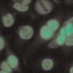 There is no staining in the chromosome area of the 1:80 metaphase mitotic cells (c). This is a mixed pattern, ANA positive. The two patterns present are speckled and SS-A/Ro.