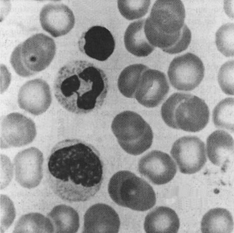 3 The photograph shows some blood cells. 10 (a) Red blood cells are adapted to carry oxygen. One way they are adapted is their small size. This allows them to pass through very small capillaries.