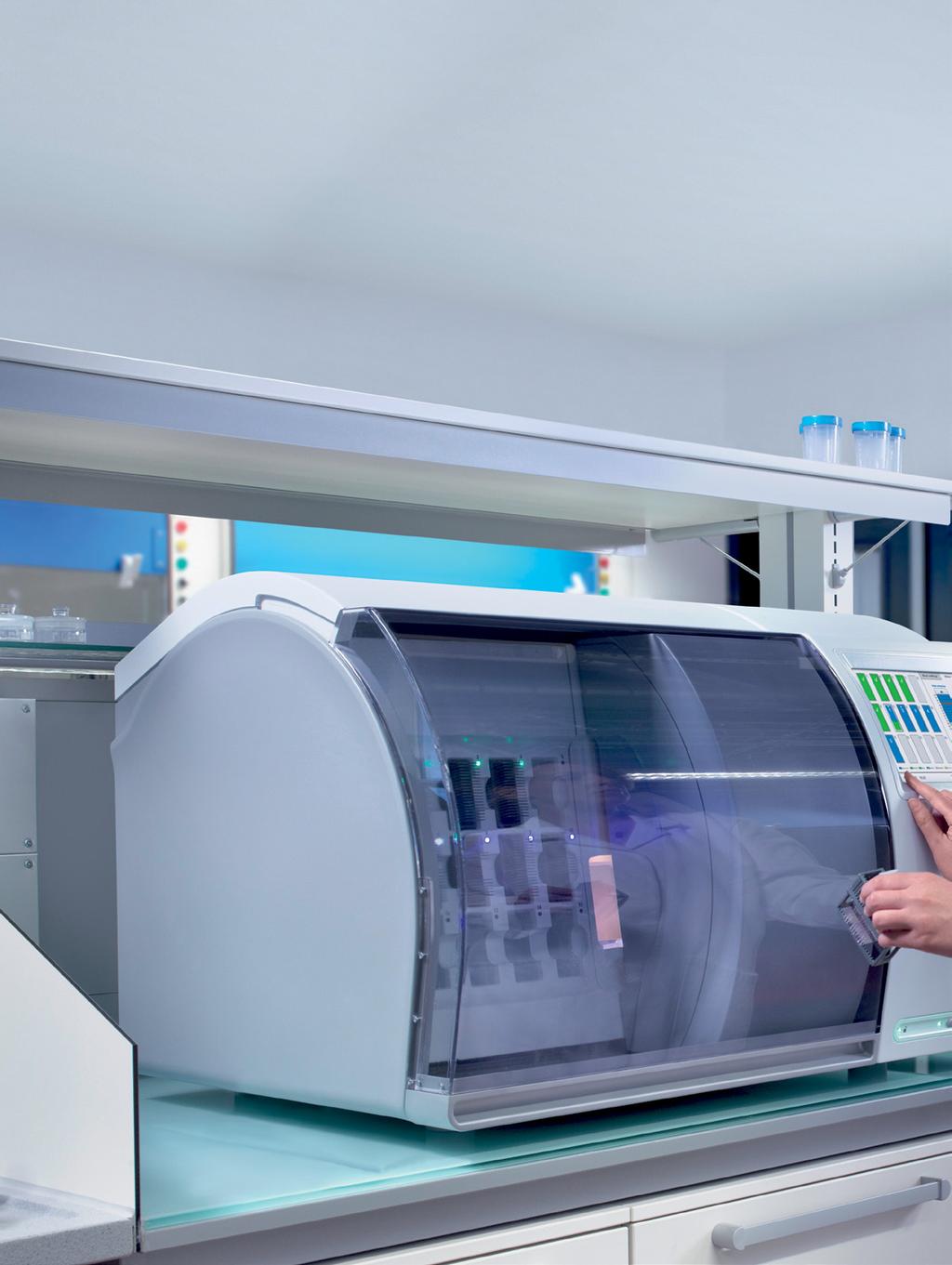 Engineered to meet the needs of today s digital pathology labs Philips IntelliSite Pathology Solution Ultra Fast Scanner (UFS), the easy-to-use UFS combines high image quality with high speed