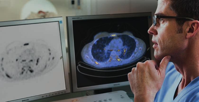 Philips Ingenuity TF PET/CT for high-fidelity imaging without tradeoffs With Ingenuity TF, clinicians are well equipped to face the most challenging issues: