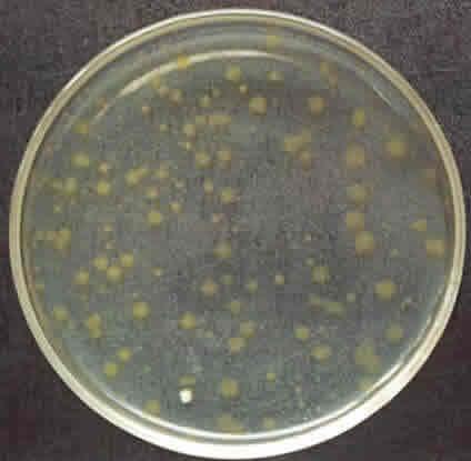 Heterotrophic Plate Count An estimation of the number of live bacteria Quantified as the number of colony forming units (cfu) per 100 ml