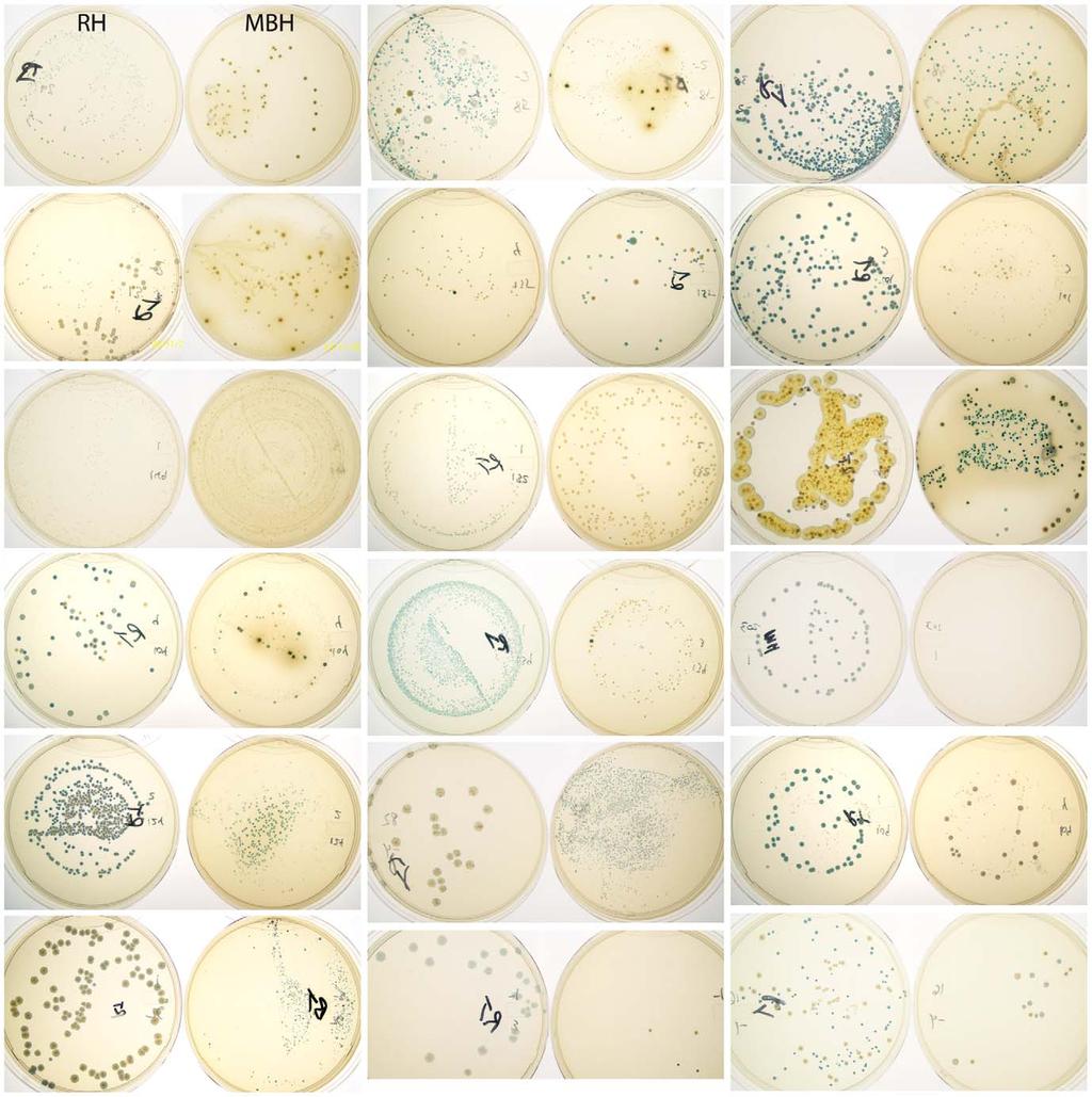generated for each individual is strikingly unique (Fig. 2). Several samples produced colonies with very dark blue colour and some with green or even yellow colour (eg. individual 2360, Fig.