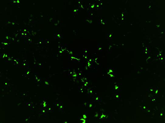 5 µl/well 12-well plate GFP plasmid, 1.3 µg/well MEF-conditioned medium with FGF-basic Gibco Geltrex matrix 3.