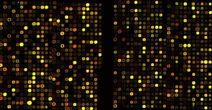 Transkriptomika Izražanje genov na nivoju celotnega organizma Relacija mrna aktivnost proteinov Metode DNA-mikromreže (microarrays) PCR v realnem času (real-time PCR,