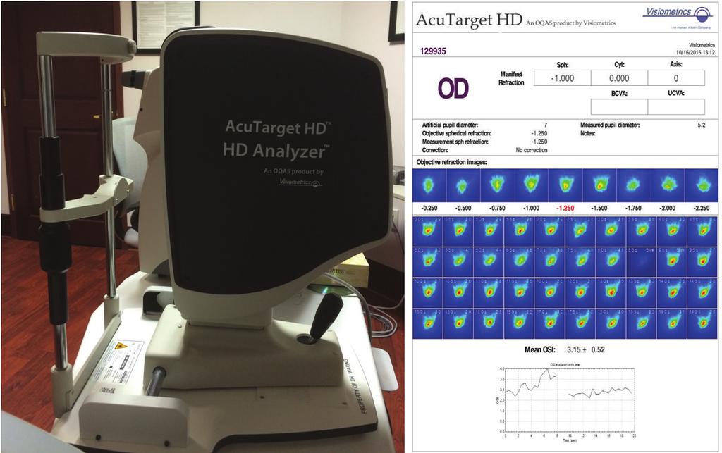2 Ophthalmology Figure 1: The AcuTarget HD and representation of objective scatter index and tear film analysis.