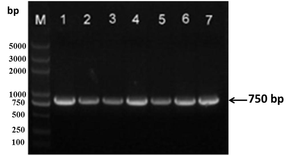 S1 of S6 Supplementary Materials: Inducible Expression of both ermb and ermt Conferred High Macrolide Resistance in Streptococcus gallolyticus subsp.